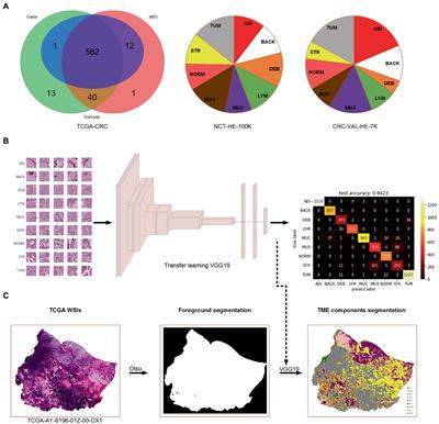Prognostic prediction based on histopathologic features of tumor microenvironment in colorectal cancer